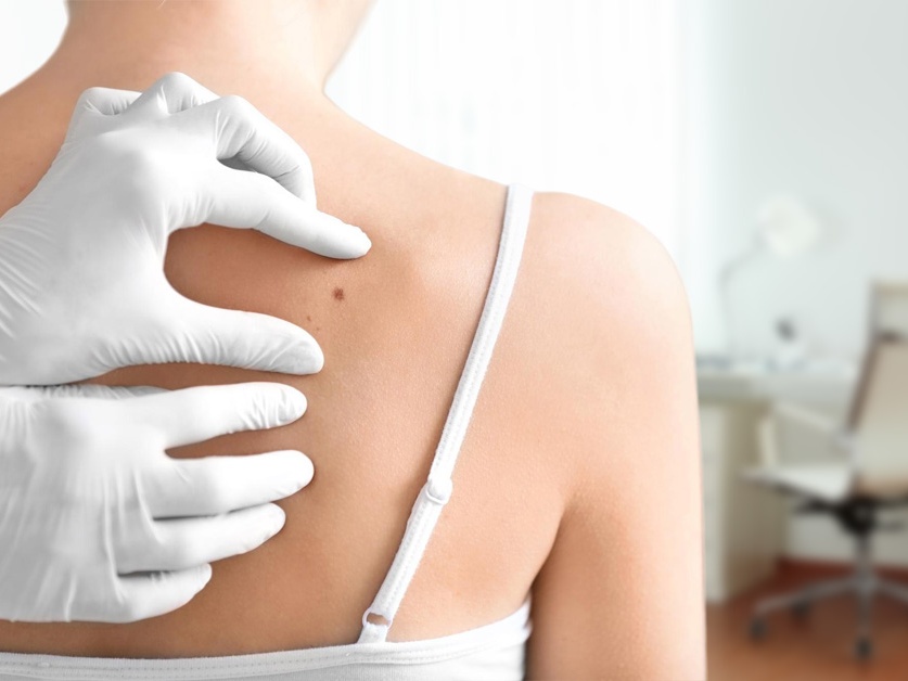 Kožní a lymfologická ambulance Dermalink - MUDr. Kellerová, MUDr. Baudyšová